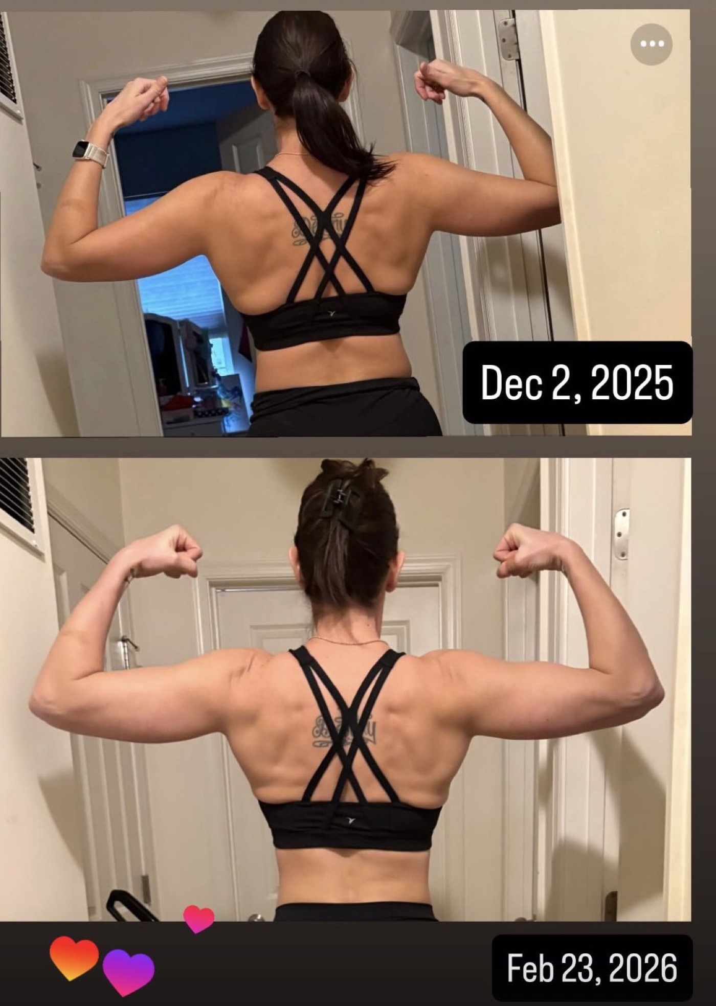 Lindsey's back progress photos